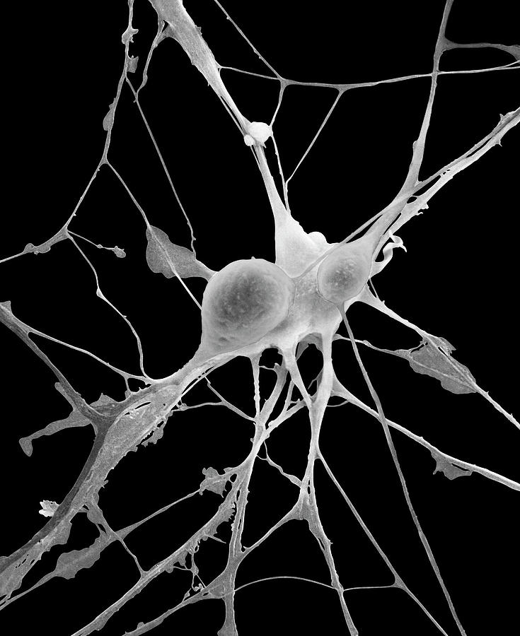 Pyramidal Neurons From Cns #6 Photograph by Dennis Kunkel Microscopy/science Photo Library
