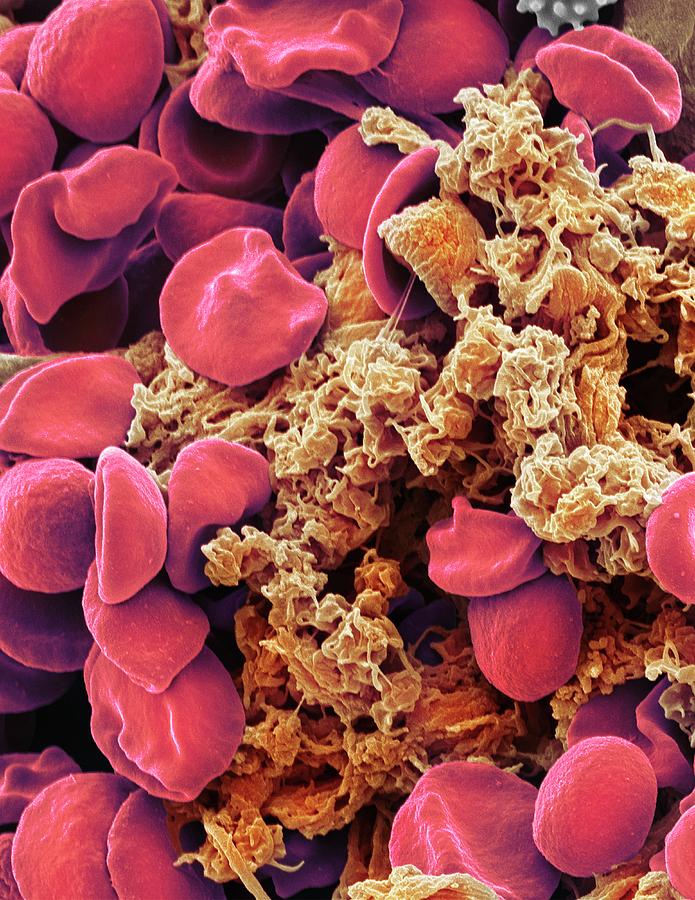 Red Blood Cells And Platelets Photograph by Steve Gschmeissner - Fine ...