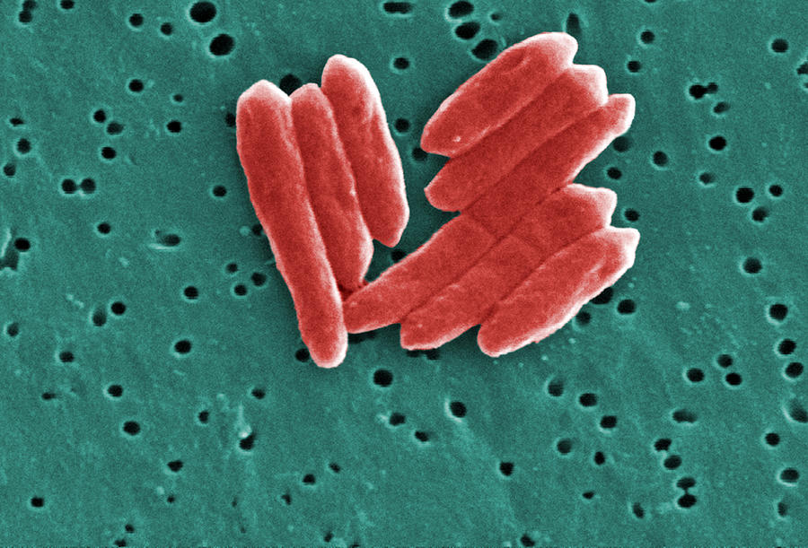 Sebaldella Termitidis Bacteria #6 Photograph by Science Source