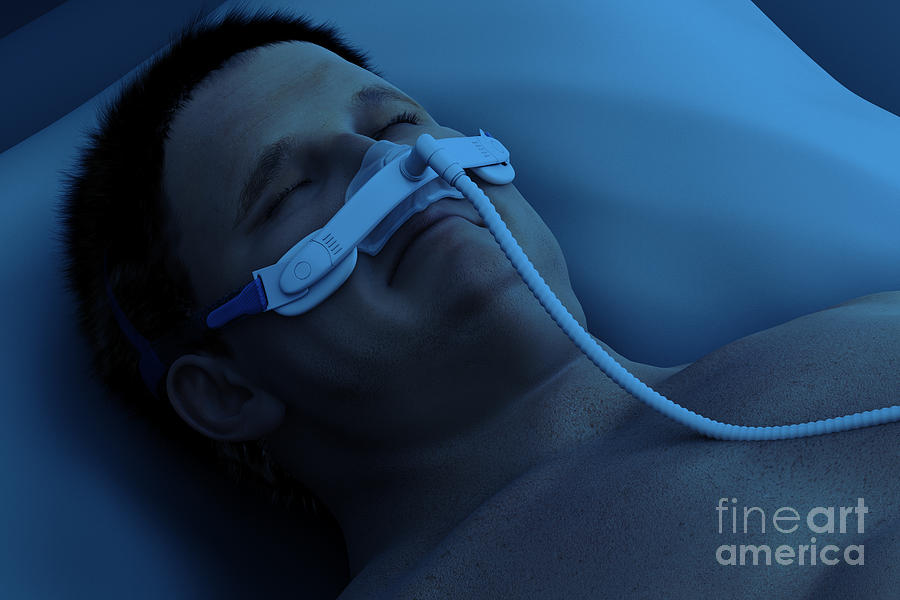 Sleep Apnea #6 Photograph by Science Picture Co