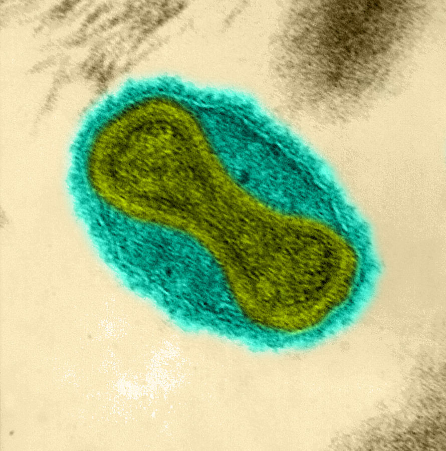 Smallpox Virus, Tem #6 Photograph by Science Source