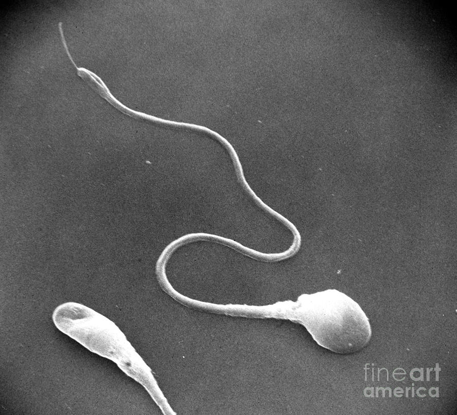 Sem Photograph - Sperm #6 by David M. Phillips