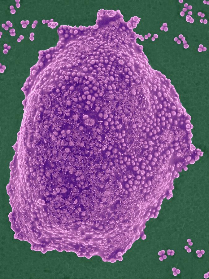 Staphylococcus Aureus Colony Mrsa Strain Photograph By Dennis Kunkel