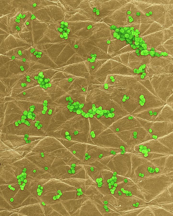 Staphylococcus Aureus On Human Skin Photograph By Dennis Kunkel