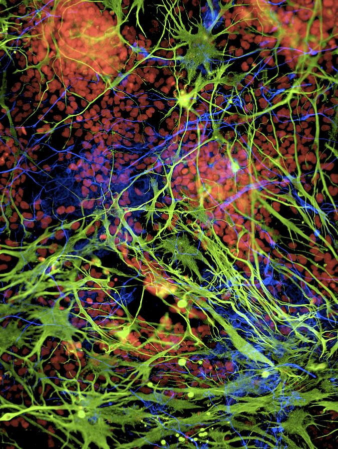 Biological Photograph - Stem cell-derived nerve cells #6 by Science Photo Library