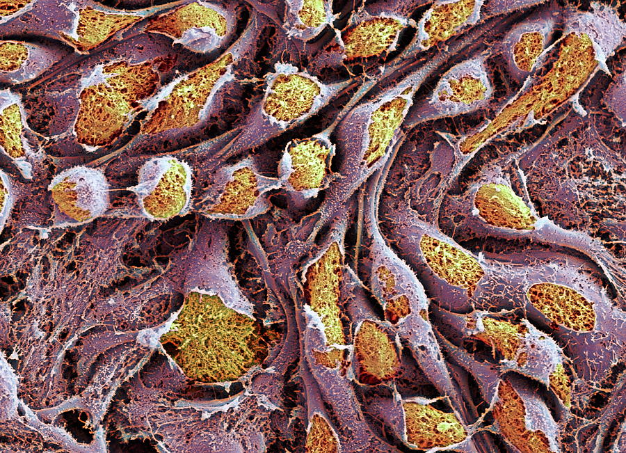 Stem Cells #6 Photograph by Professor Miodrag Stojkovic/science Photo Library