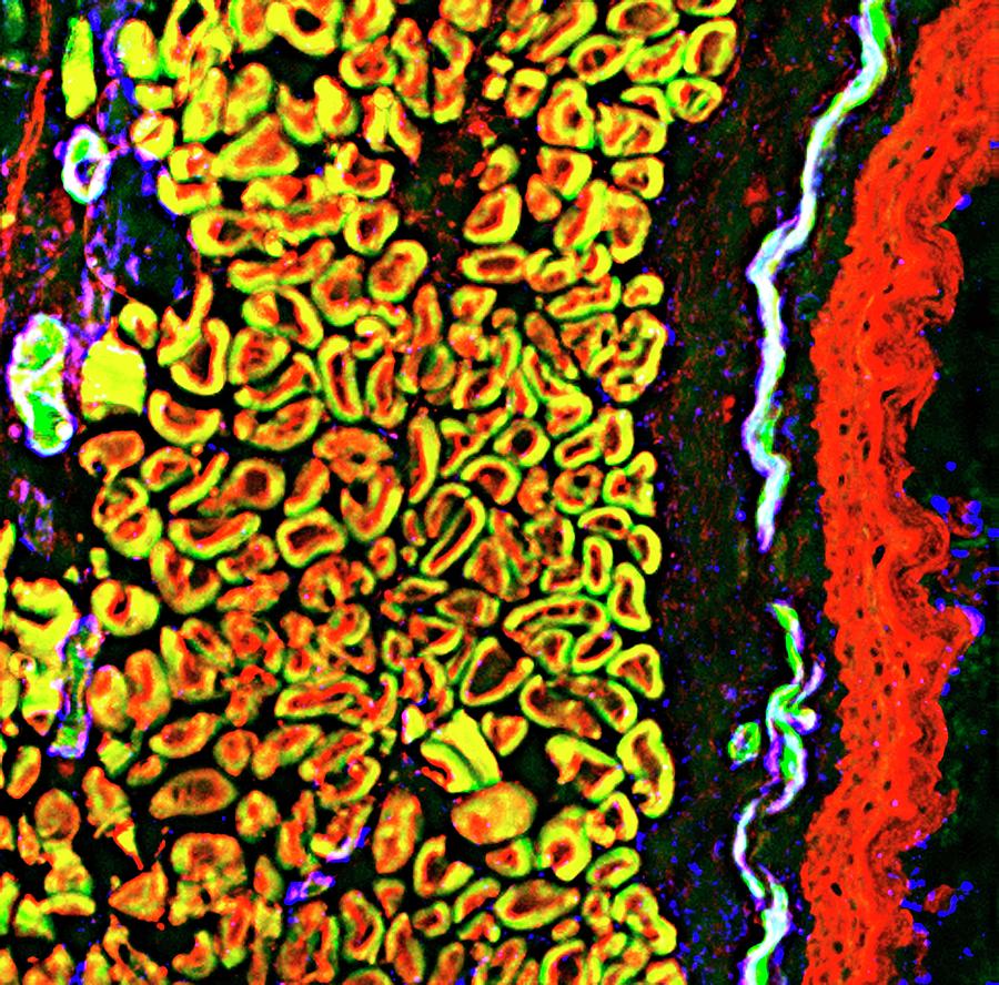 Throat Tissue Photograph by R. Bick, B. Poindexter, Ut Medical School/science Photo Library