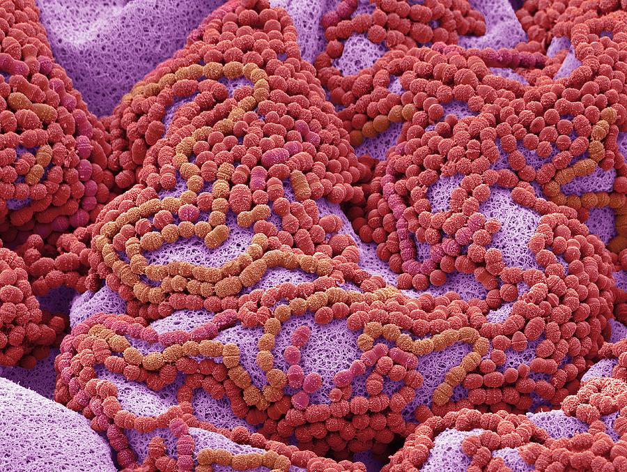 Tooth Bacteria #6 by Steve Gschmeissner/science Photo Library