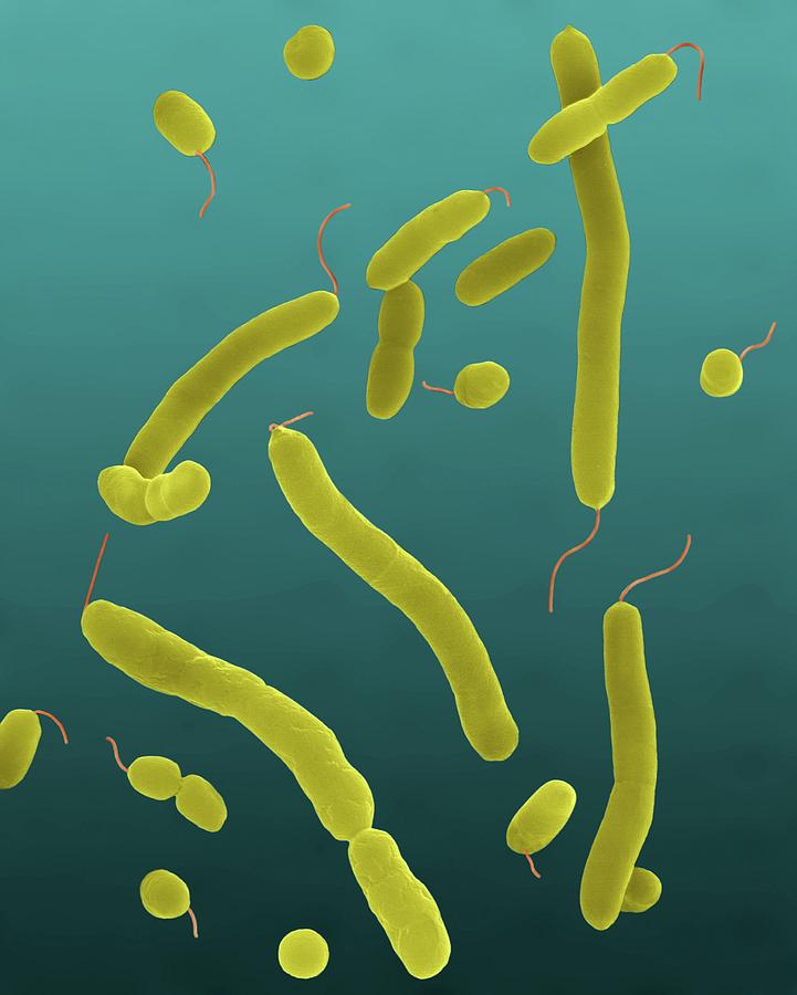 Трутовик окаймленный холерный вибрион. Микроскопия вибрион парагемолитикус. Vibrio parahaemolyticus микроскопия. Vibrio parahaemolyticus микробиология. Парагемолитический вибрион морфология.