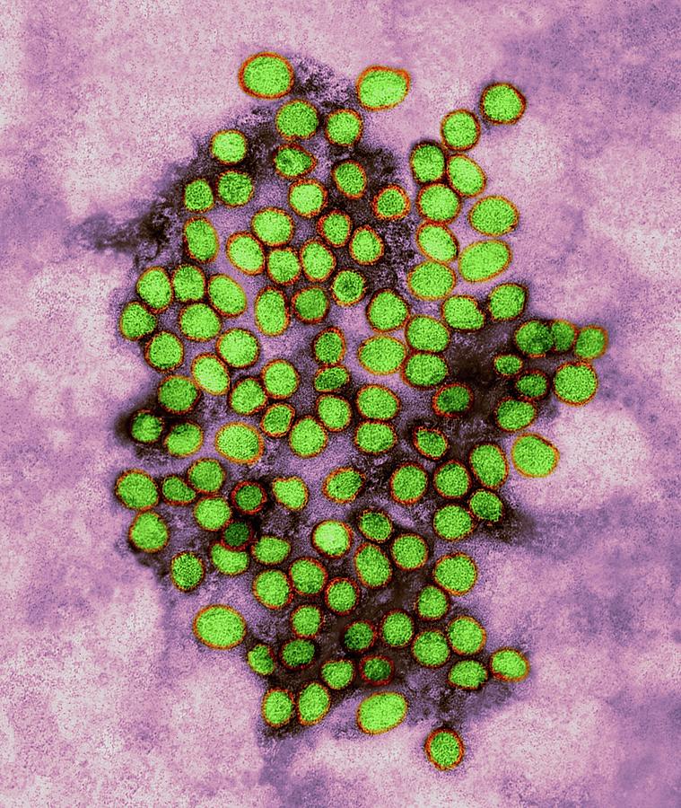 Yellow Fever Virus Photograph by Dennis Kunkel Microscopy/science Photo ...