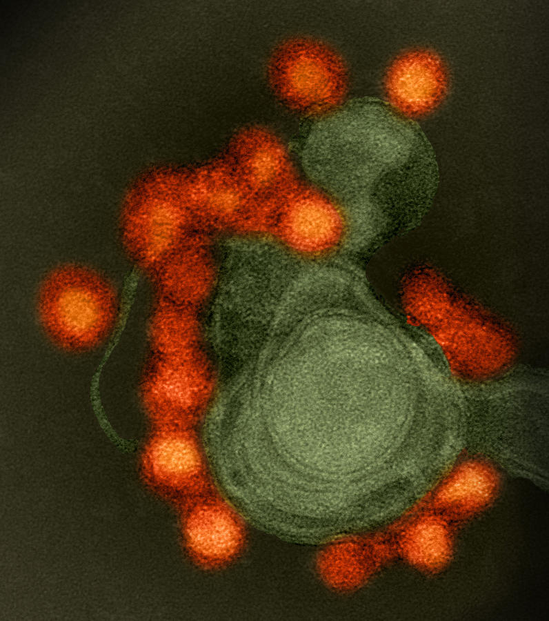 Zika Virus, Tem #6 Photograph by Science Source