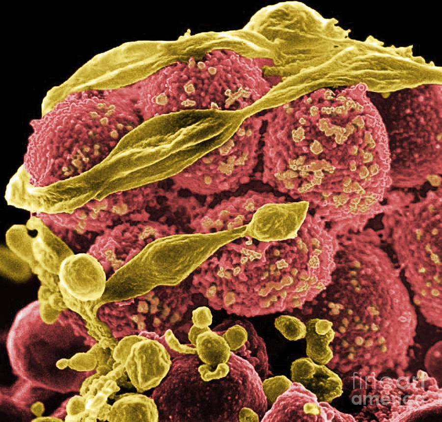 Methicillin-resistant Staphylococcus #63 Photograph by Science Source
