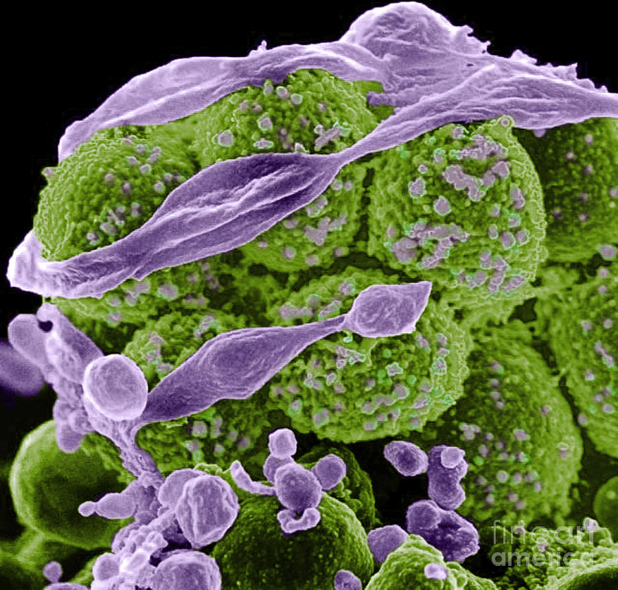 Methicillin-resistant Staphylococcus #61 Photograph by Science Source