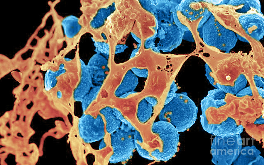 Methicillin-resistant Staphylococcus #60 Photograph by Science Source