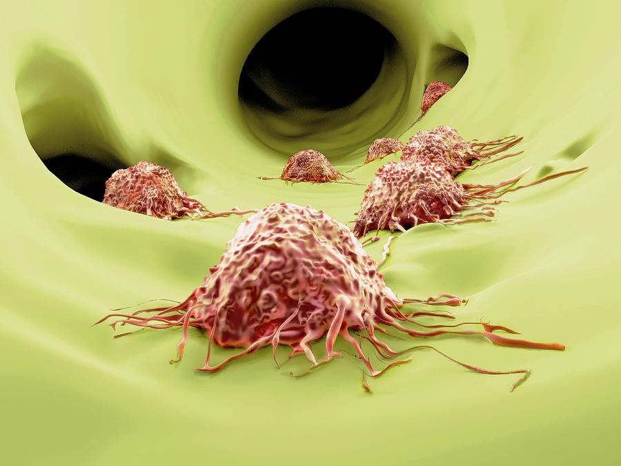 Cancer Cells, Artwork #1 Photograph by Juan Gaertner