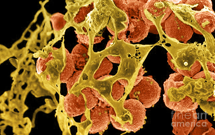 Methicillin-resistant Staphylococcus #64 Photograph by Science Source