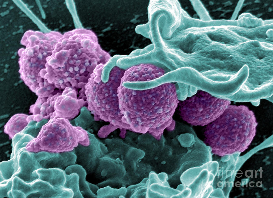 Methicillin-resistant Staphylococcus #65 Photograph by Science Source
