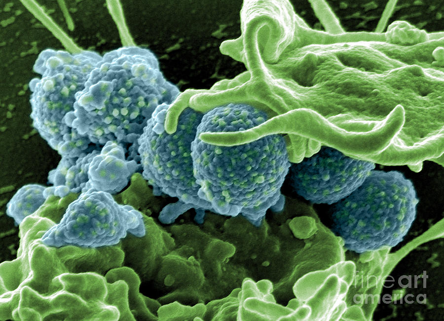 Methicillin-resistant Staphylococcus #66 Photograph by Science Source