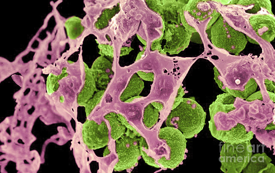 Methicillin-resistant Staphylococcus #68 Photograph by Science Source