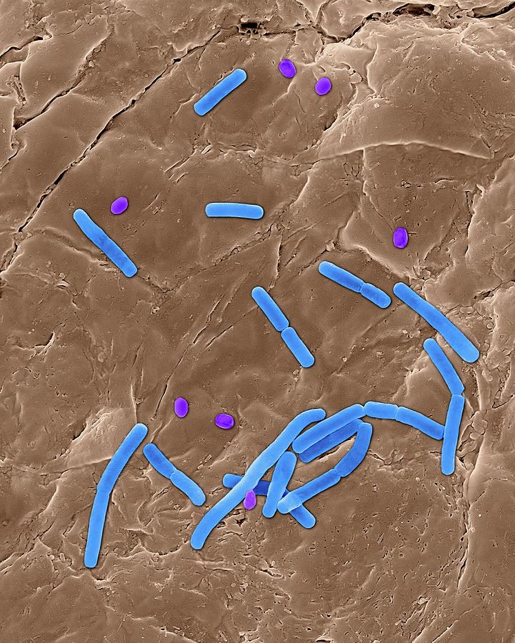 Bacillus Anthracis Photograph By Dennis Kunkel Microscopy Science Photo