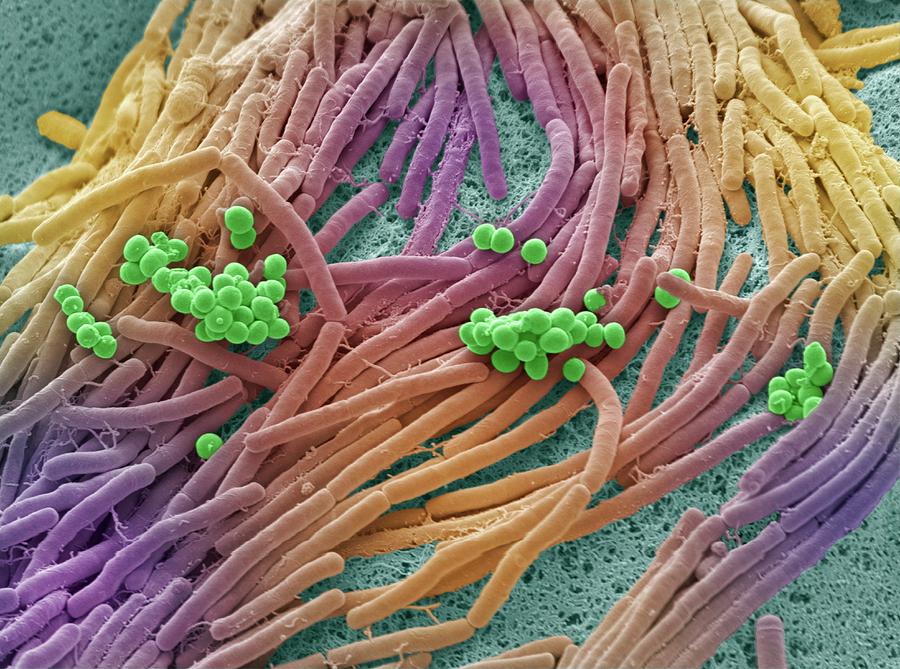 Bacteria Found On Mobile Phone Photograph By Steve Gschmeissner Science