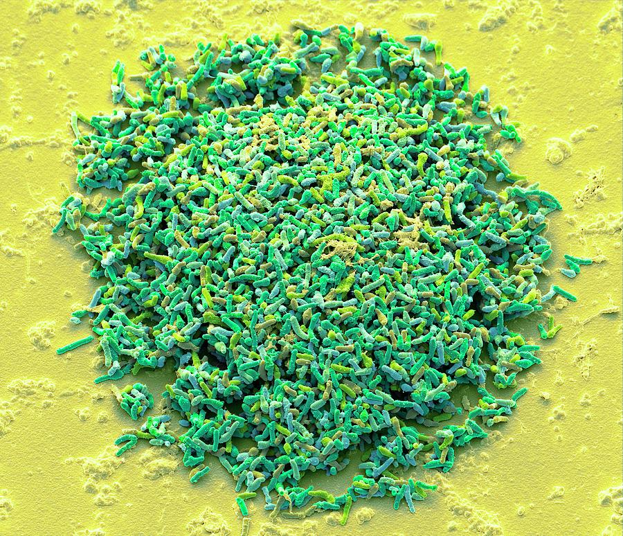 Bacterial Colony #7 by Steve Gschmeissner/science Photo Library