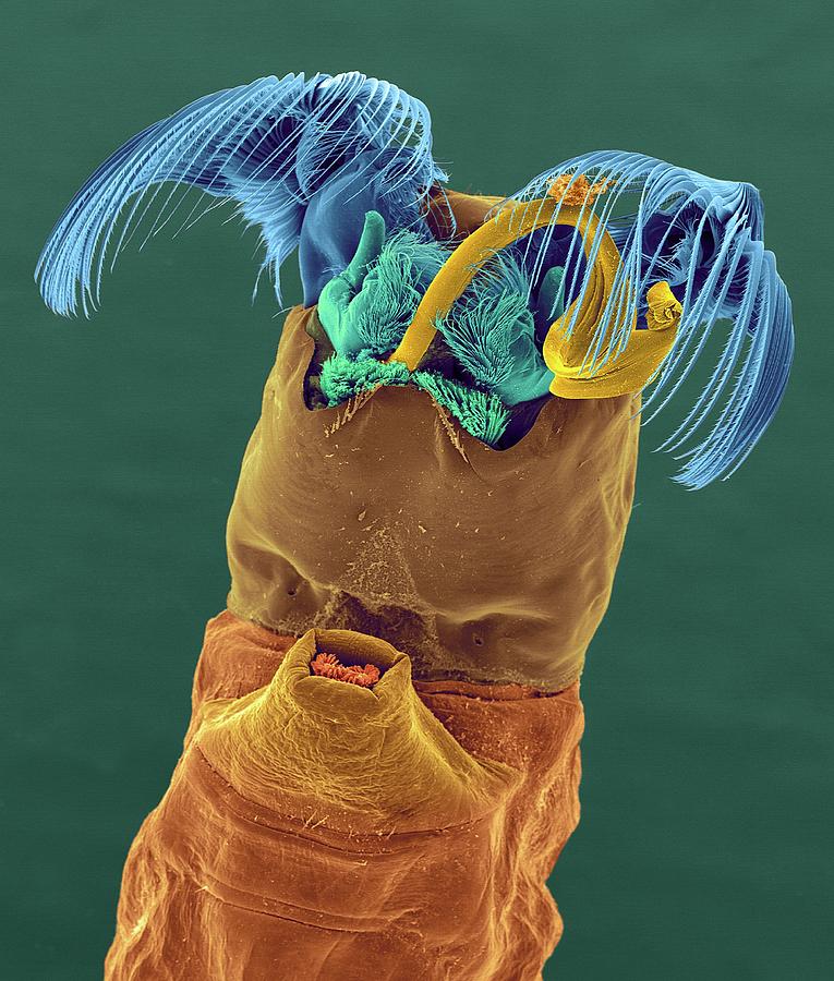 Black Fly Larva Photograph by Dennis Kunkel Microscopy/science Photo ...