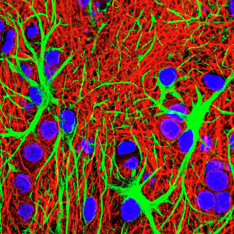 Brain Cells #7 Photograph by Dr. Chris Henstridge