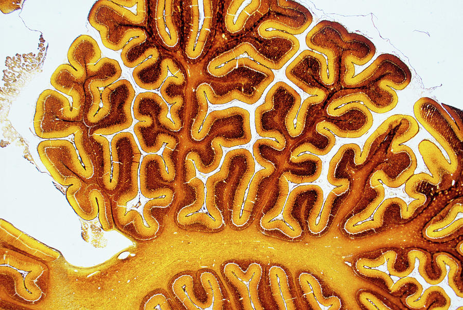 Brain Tissue Photograph by Innerspace Imaging/science Photo Library
