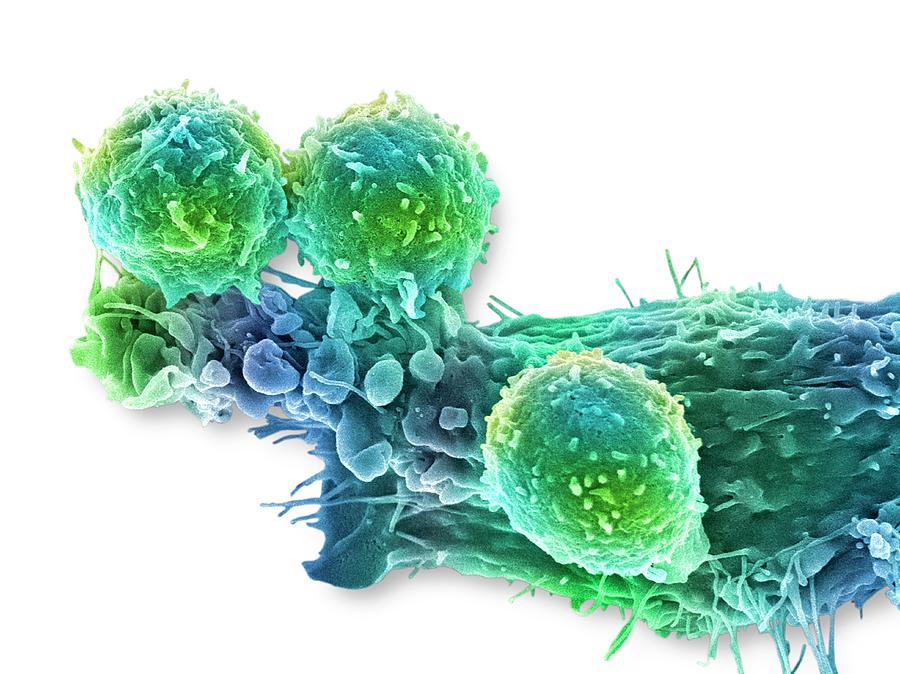 Cancer Cell And T Lymphocytes #7 Photograph by Steve Gschmeissner