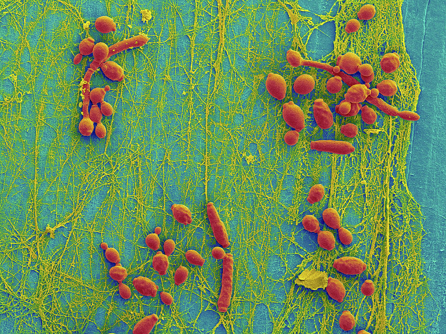 Candida Infected Medical Catheter Photograph by Dennis Kunkel ...