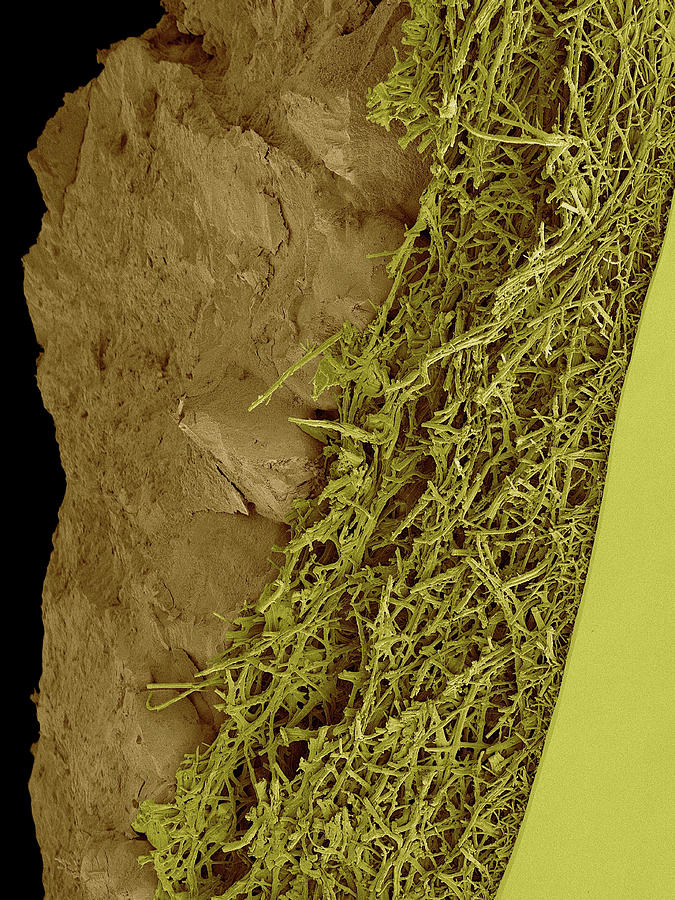 Chicken Eggshell Cross Section #7 Photograph by Dennis Kunkel Microscopy/science Photo Library
