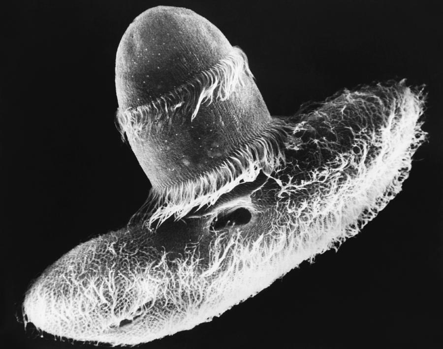 Didinium Ingesting Paramecium Sem #7 Photograph by Greg Antipa