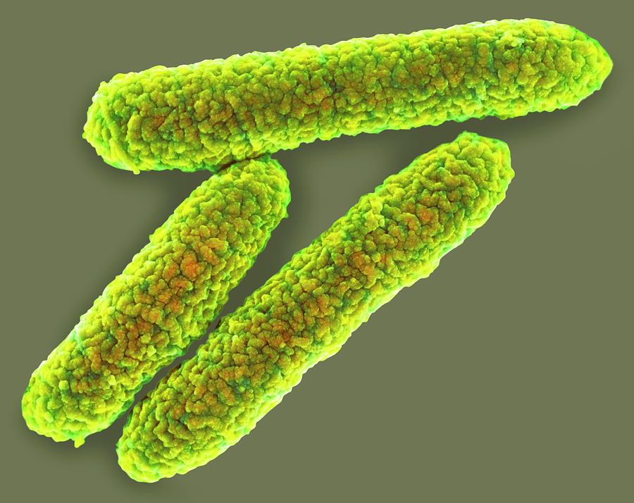 Escherichia Coli Photograph - E. Coli Bacteria #7 by Science Photo Library
