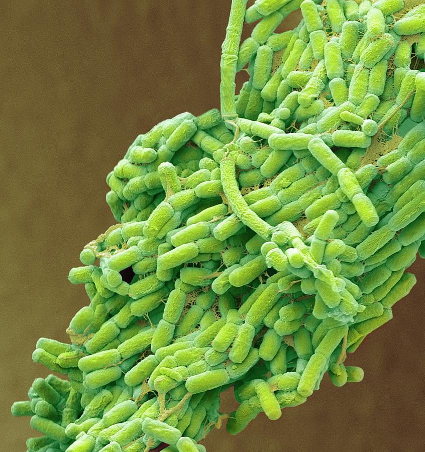 Escherichia Coli Photograph - E. Coli Bacteria #7 by Steve Gschmeissner
