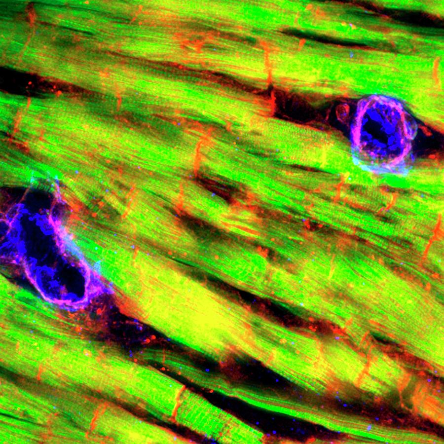 Heart Tissue Photograph by R. Bick, B. Poindexter, Ut Medical School/science Photo Library