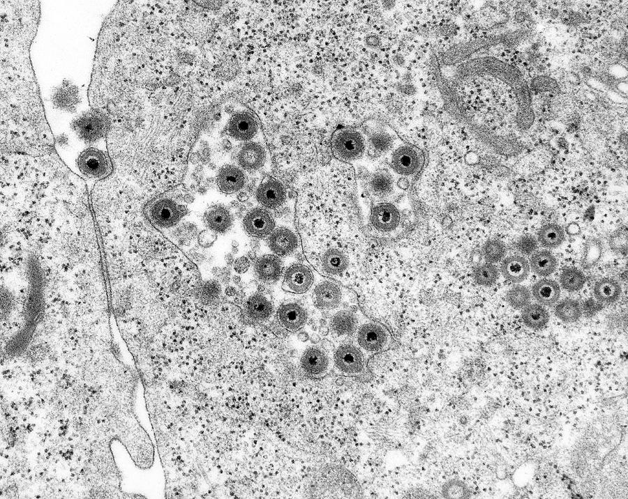 Herpes Simplex Virus #7 Photograph by Dennis Kunkel Microscopy/science Photo Library