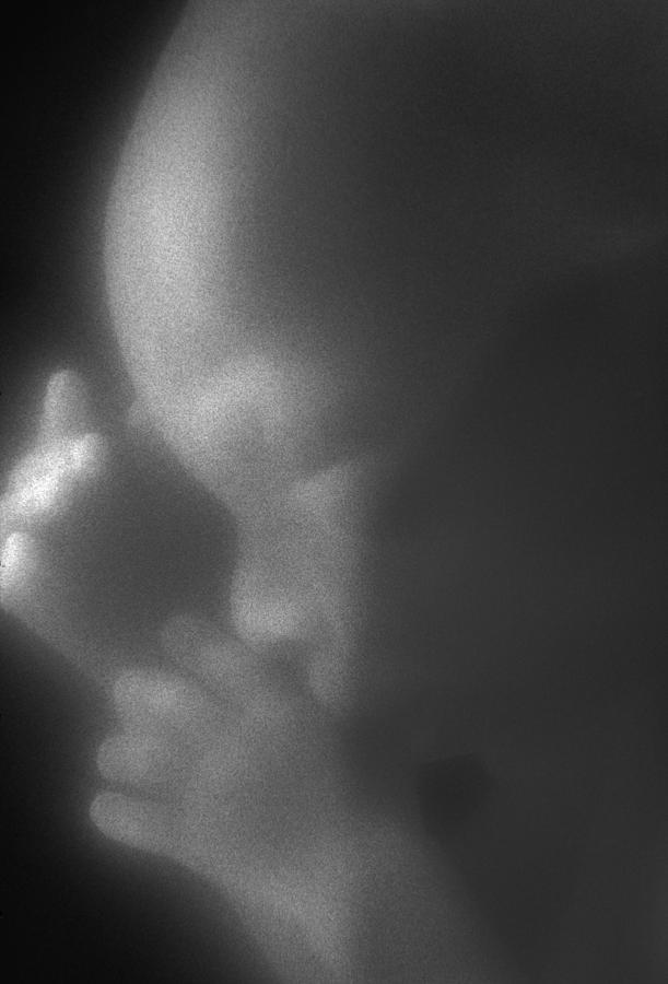 Black And White Photograph - Human foetus in the womb #7 by Science Photo Library