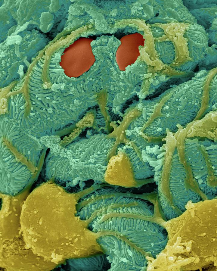 Kidney Glomerulus #7 Photograph by Dennis Kunkel Microscopy/science Photo Library