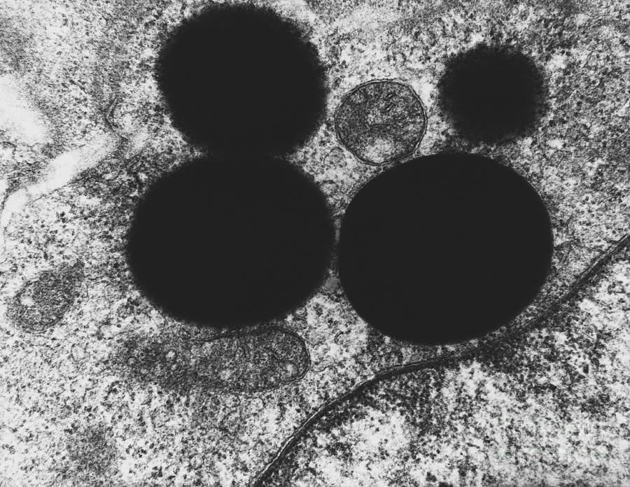 Lipid Droplets, Tem #7 Photograph by David M. Phillips