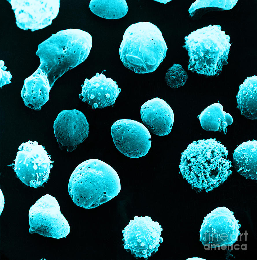 White Blood Cell Photograph - Lymphocytes Undergoing Apoptosis, Sem #7 by David M. Phillips