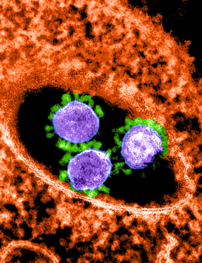 Mers-cov, Betacoronavirus, Tem #7 Photograph by Science Source