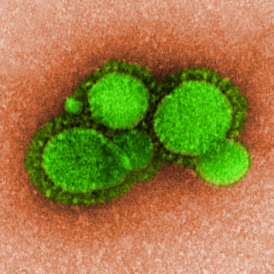 Mers-cov Middle East Respiratory #7 Photograph by Science Source