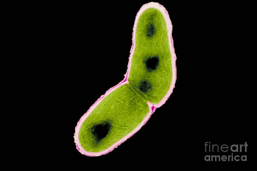 Transmission Electron Microscope Photograph - Mycobacterium Tuberculosis #7 by Kwangshin Kim