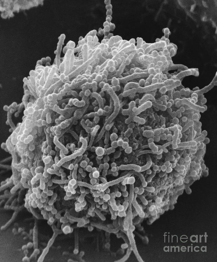 Bacterial Photograph - Mycoplasma Bacteria, Sem #7 by David M. Phillips