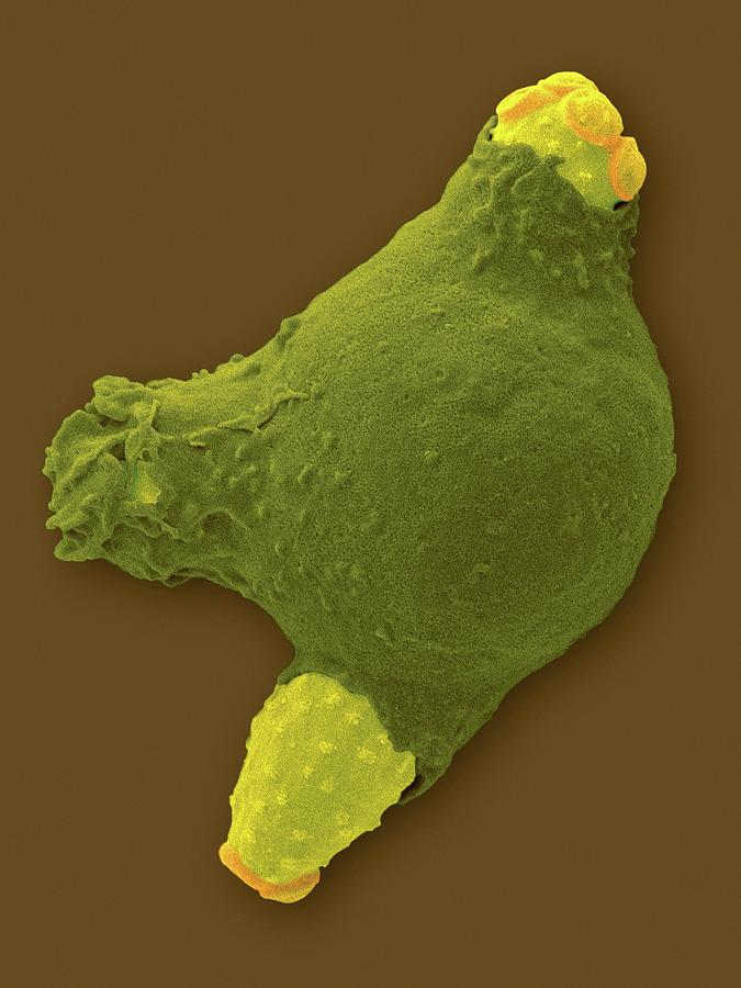 Neutrophil Phagocytosis Of Candida Photograph By Dennis Kunkel Microscopyscience Photo Library 