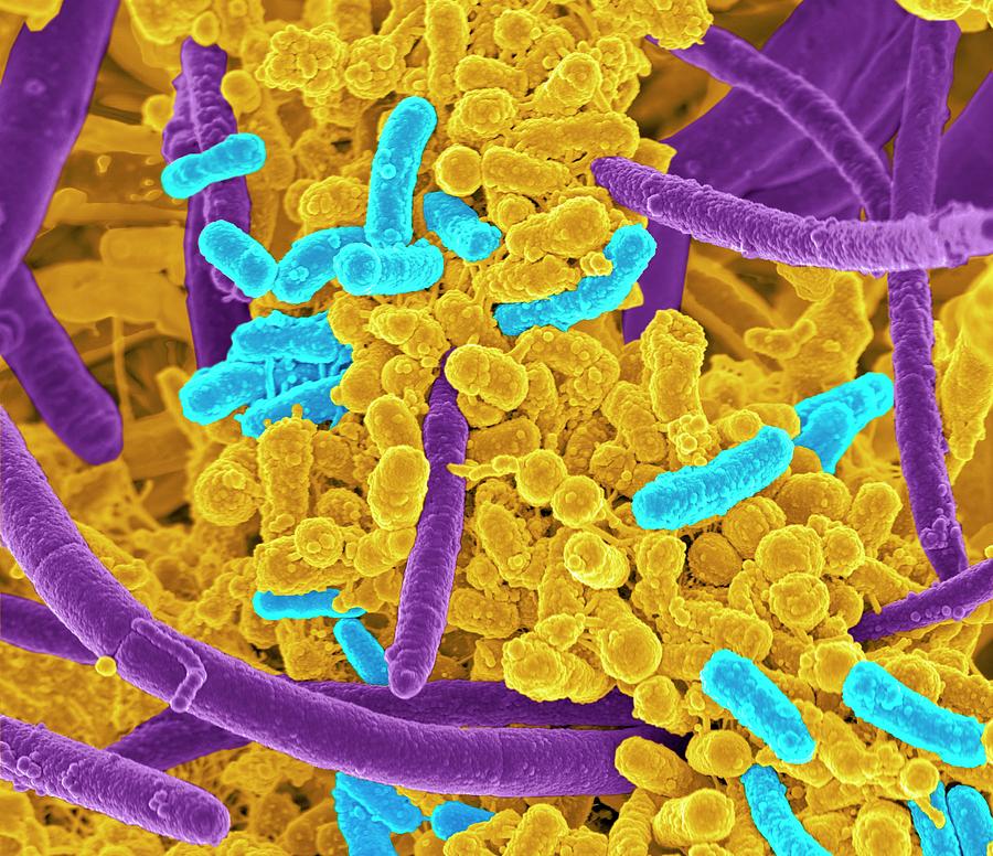 Oral Bacteria Photograph By Science Photo Library Fine Art America