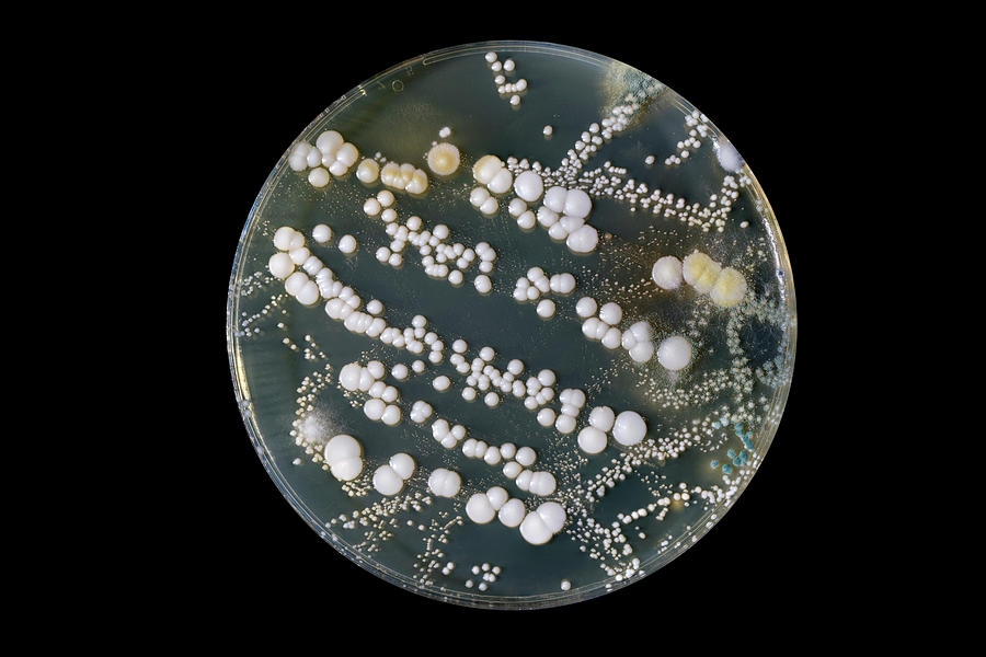 Petri Dish With Bacteria Photograph by Wladimir Bulgar/science Photo ...