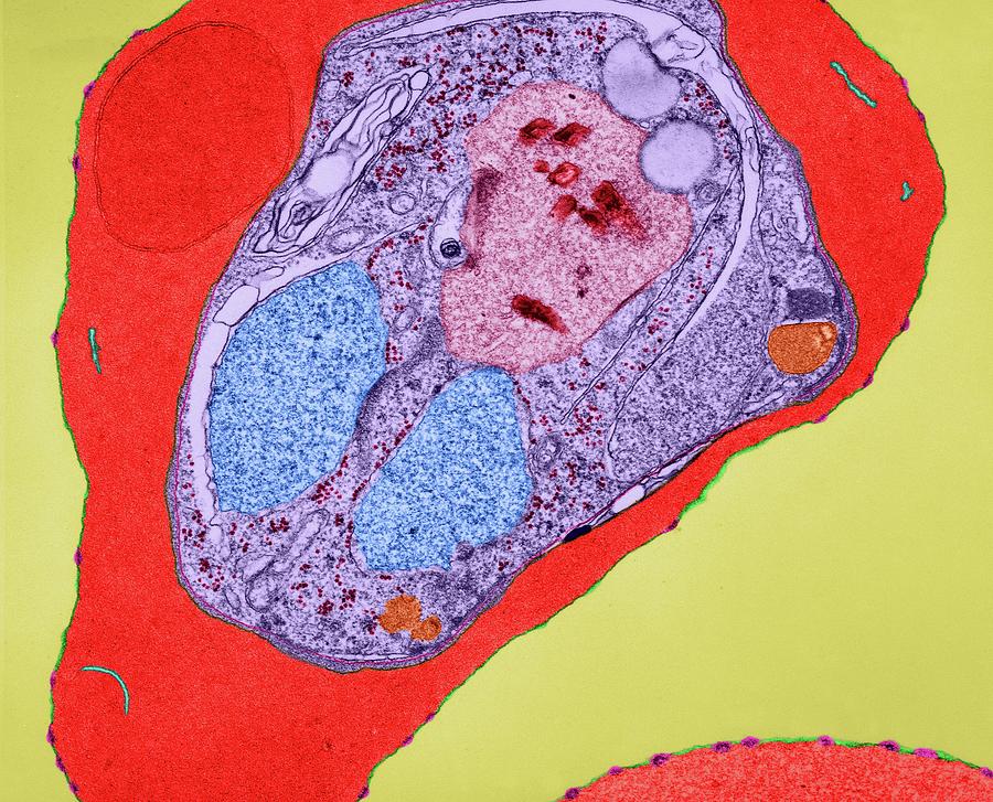 Plasmodium Falciparum #7 Photograph by Dennis Kunkel Microscopy/science Photo Library