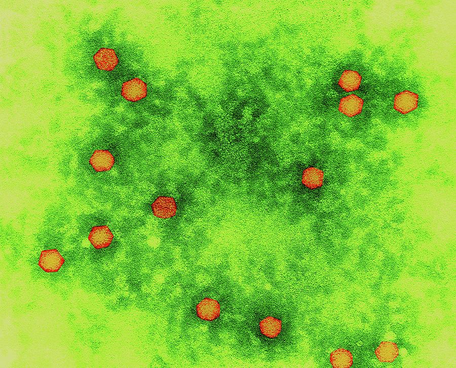 Human Pathogen Photograph - Polio Virus #7 by Dennis Kunkel Microscopy/science Photo Library